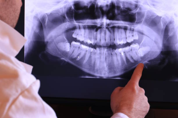Best Emergency Root Canal Therapy in Southwest Sandhill, TX