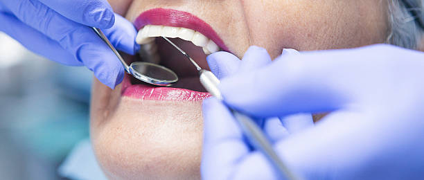 Best Knocked-Out Tooth (Avulsed Tooth) Treatment in Southwest Sandhill, TX